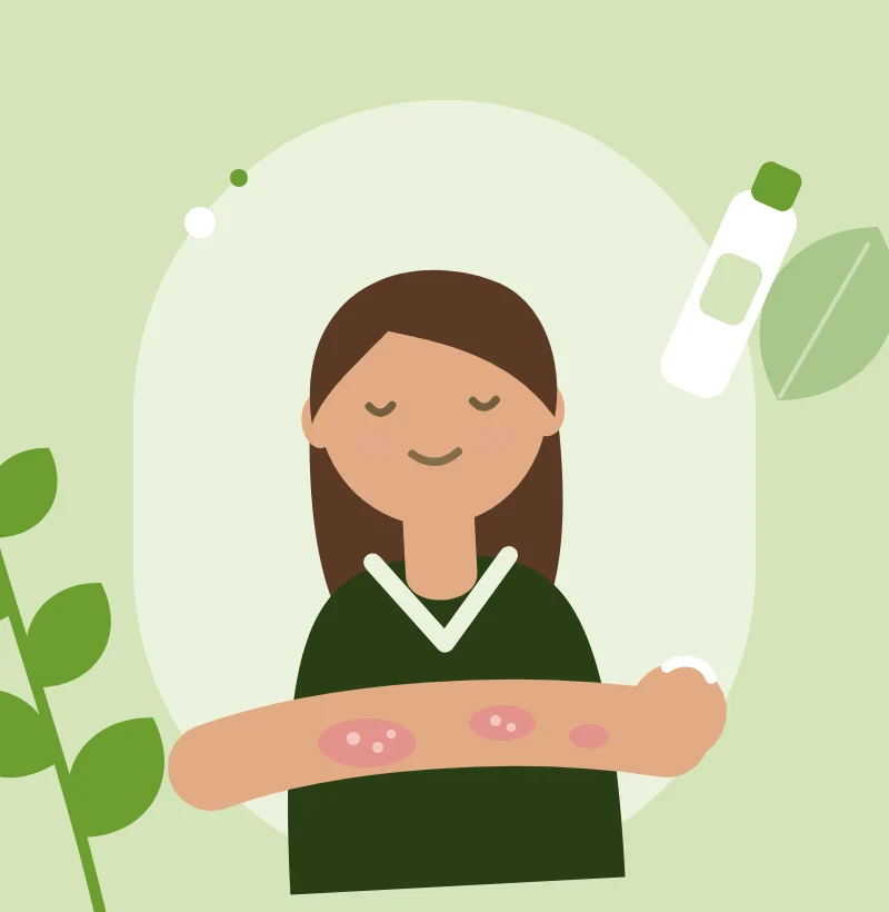 Illustration of a person calmly applying cream to psoriasis patches on their forearm